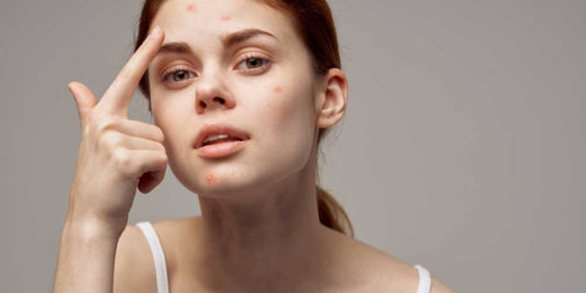 What is the best skincare routine for acne-prone skin?